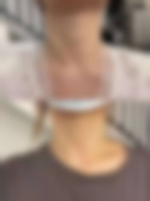 优惠活动详情:限时折扣,到院即享