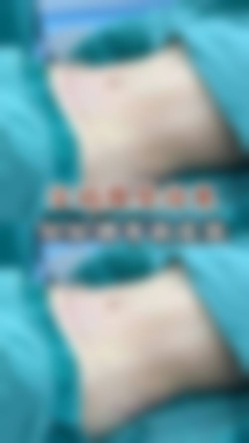 服务流程:从询问到术后管理的全程关怀