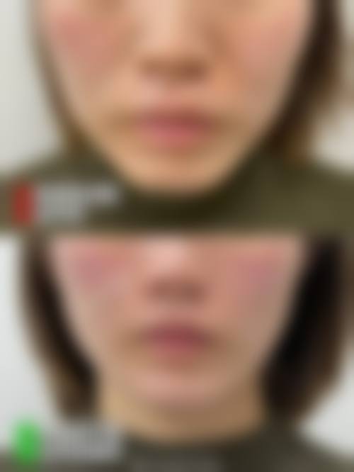 八、青叶Clinic 横滨真实的患者评价