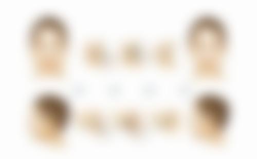 二、做了吸脂手术会反弹吗？生活习惯的影响