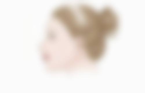 三、注射瘦脸针前后的注意事项