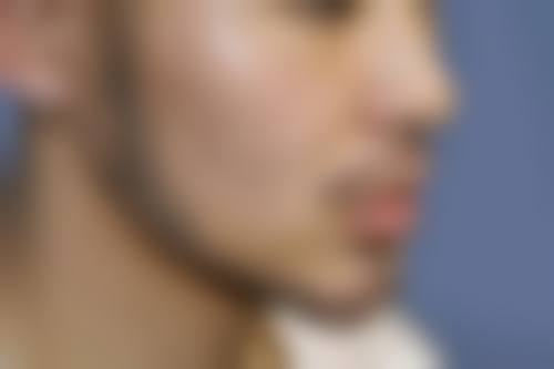 九、青岛福亚美医疗美容门诊部真实的患者评价