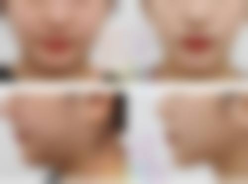 八、黑河李玉芬医疗美容诊所预约方式