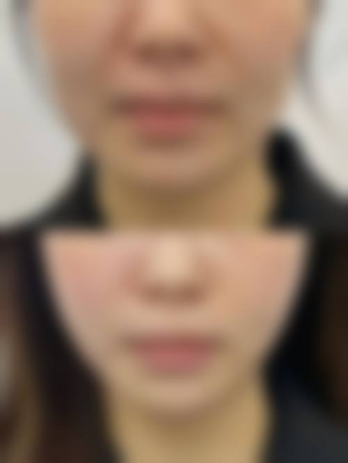 Q：天津医 科 大学总医院空港医院医疗美容科支持医疗保险报销吗？