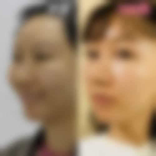 八、海城田医生美容整形门诊真实的患者评价