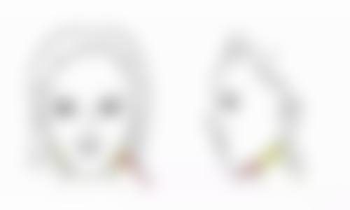 五、种植头发后脱发的应对方法