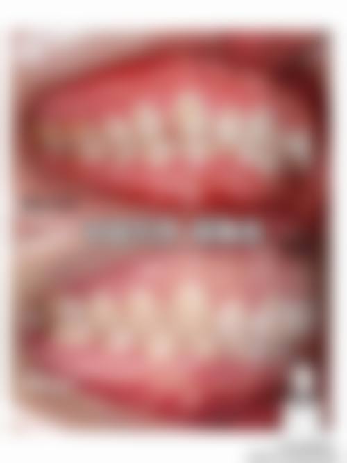 预约优惠活动