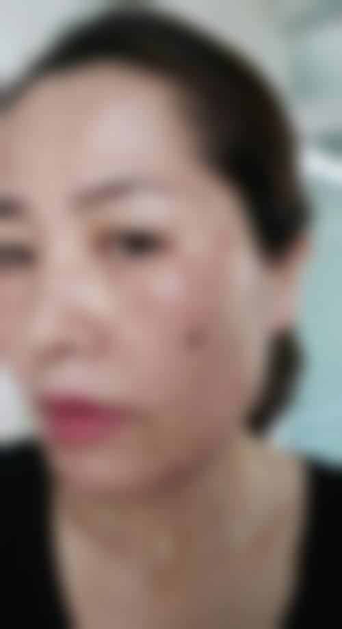四、蚌埠医学校第二附属医院(整形烧伤外科)特色项目