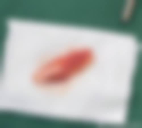 八、长沙姿尔美医疗美容门诊部真实的患者评价
