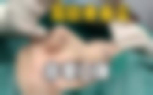 二、宁波童颜医疗美容门诊部怎么样?